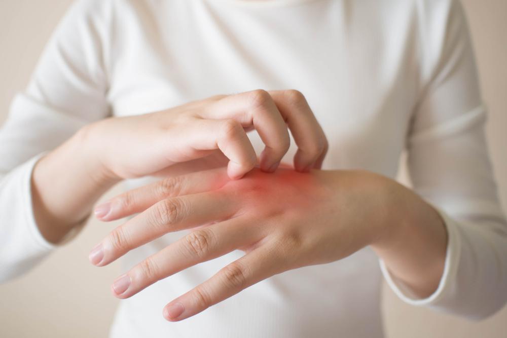 Egzema na dłoniach – przyczyny, objawy, leczenie