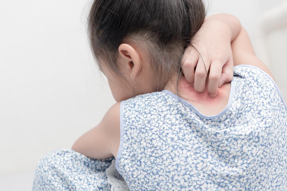Zmiany skórne u dzieci – alergia skórna, azs? Kiedy udać się do lekarza?