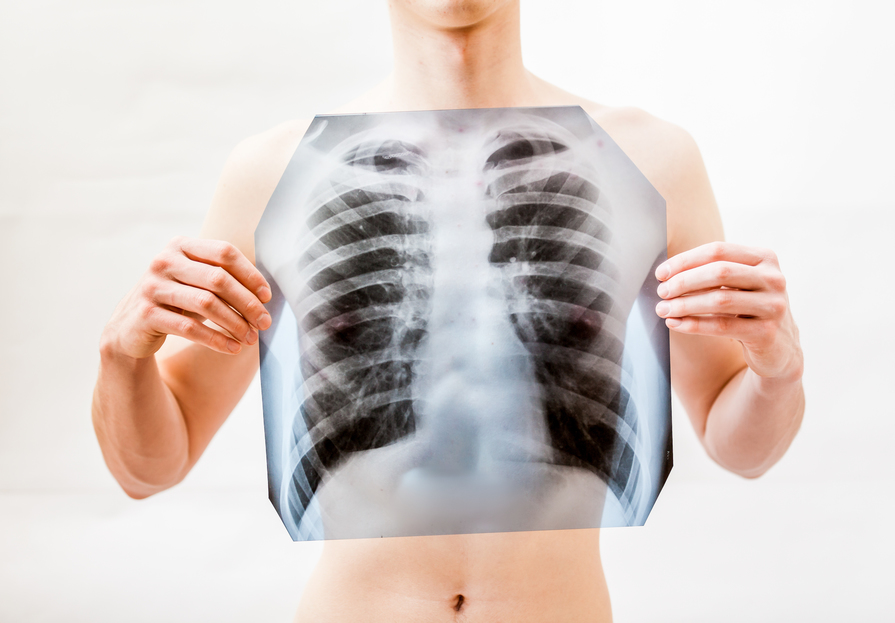 Układ oddechowy człowieka – budowa, funkcje, choroby